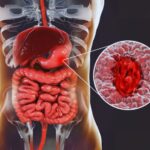 5 Ayurvedic Practices for Boosting Immunity