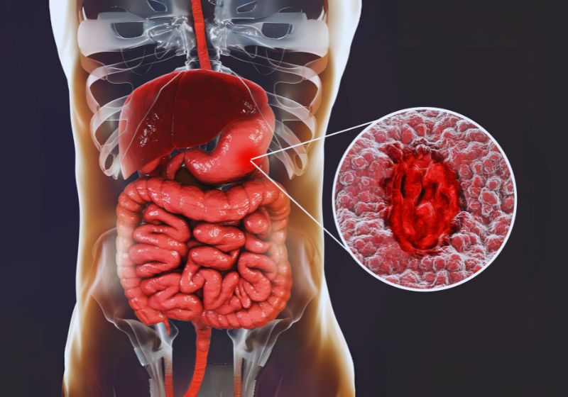 Natural Ways to Improve Gut Health