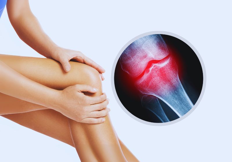 Natural Remedies for Joint Pain and Arthritis