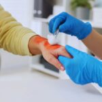 How to Treat Heartburn Naturally: A Comprehensive Guide